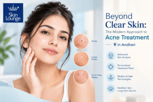 Acne Treatment in Andheri